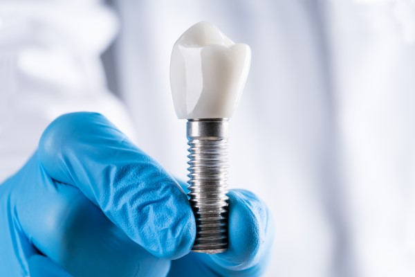 Can A General Dentist Repair A Dental Implant Restoration?