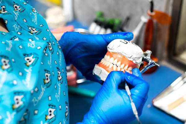 Dental Restoration Huntsville, AL