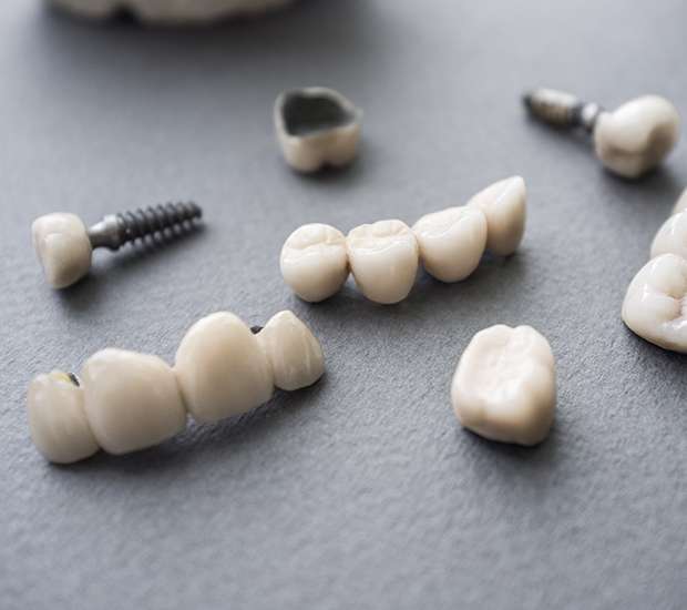Huntsville The Difference Between Dental Implants and Mini Dental Implants