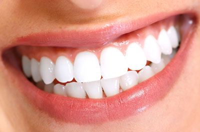 Teeth Whitening: Visiting A Dentist In Huntsville Makes A Significant Difference